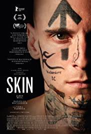 SKIN #FULL EPISODE Poster
